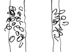 Tree 4